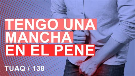 manchas en el pen negras|Lunares en el Pene